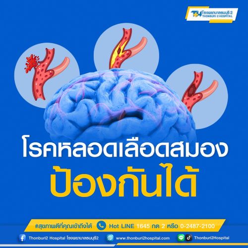 ข่าวประชาสัมพันธ์ - PR News หลอดเลือดสมองป้องกันได้ พบกับโปรแกรมคัดกรองโรคหลอดเลือดสมองที่โรงพยาบาลธนบุรี2 